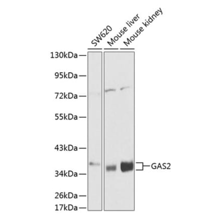 Western Blot - Anti-GAS2 Antibody (A13344) - Antibodies.com