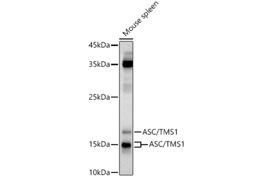 Western Blot - Anti-TMS1/ASC Antibody (A13346) - Antibodies.com