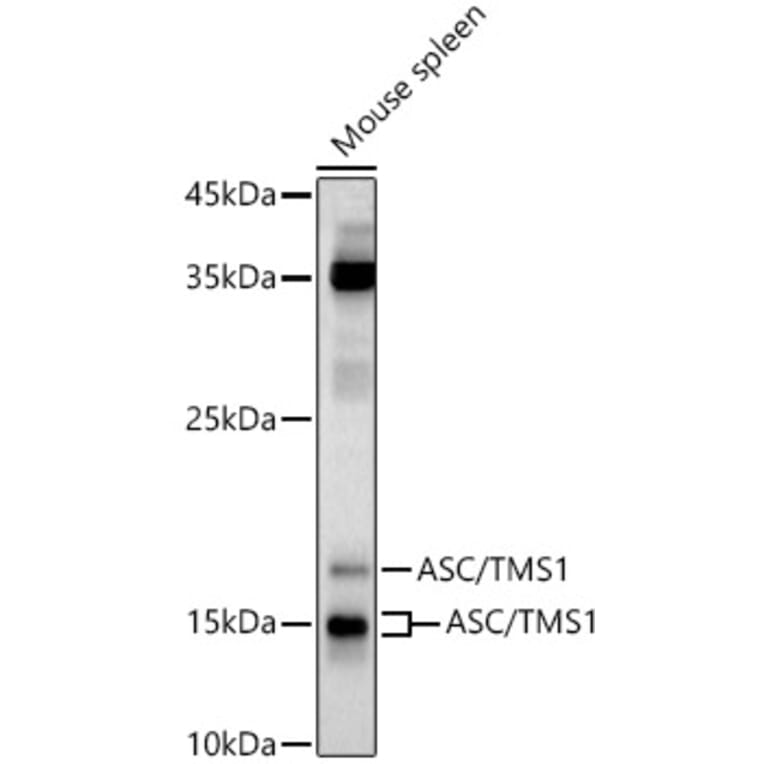 Western Blot - Anti-TMS1/ASC Antibody (A13346) - Antibodies.com