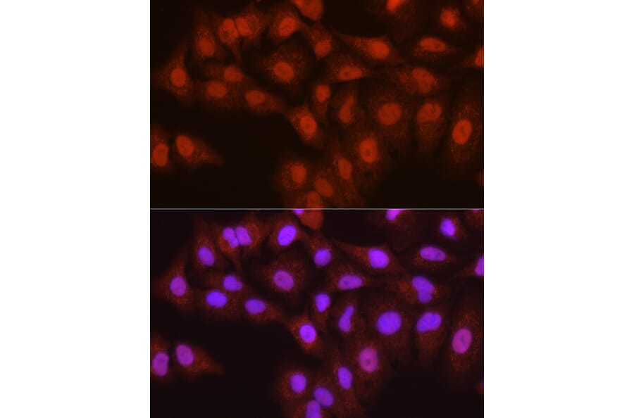 Immunofluorescence - Anti-TMS1/ASC Antibody (A13346) - Antibodies.com