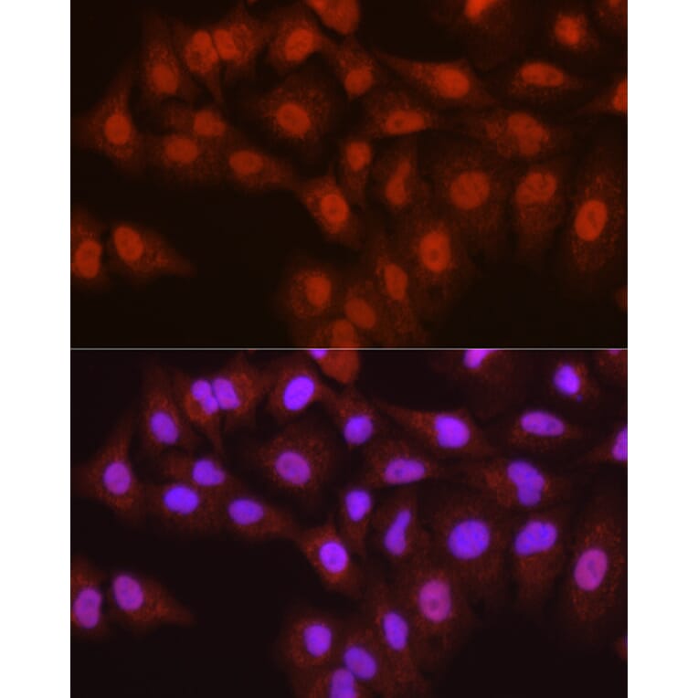 Immunofluorescence - Anti-TMS1/ASC Antibody (A13346) - Antibodies.com