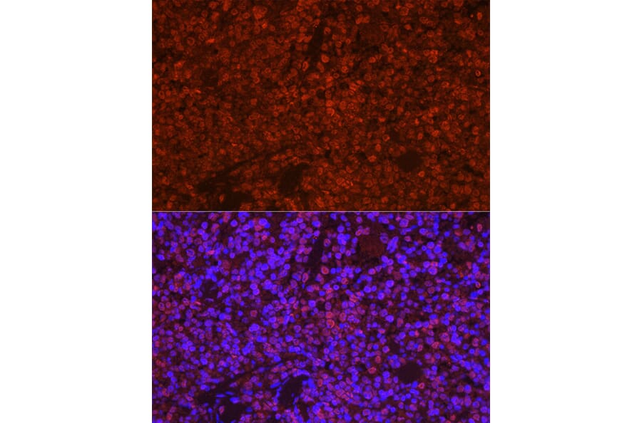 Immunofluorescence - Anti-TMS1/ASC Antibody (A13346) - Antibodies.com