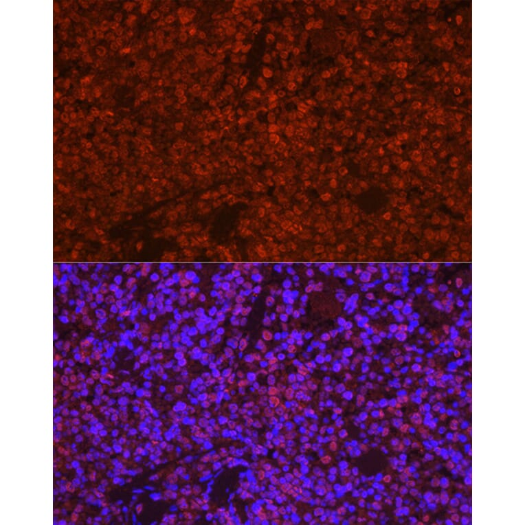Immunofluorescence - Anti-TMS1/ASC Antibody (A13346) - Antibodies.com