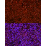 Immunofluorescence - Anti-TMS1/ASC Antibody (A13346) - Antibodies.com