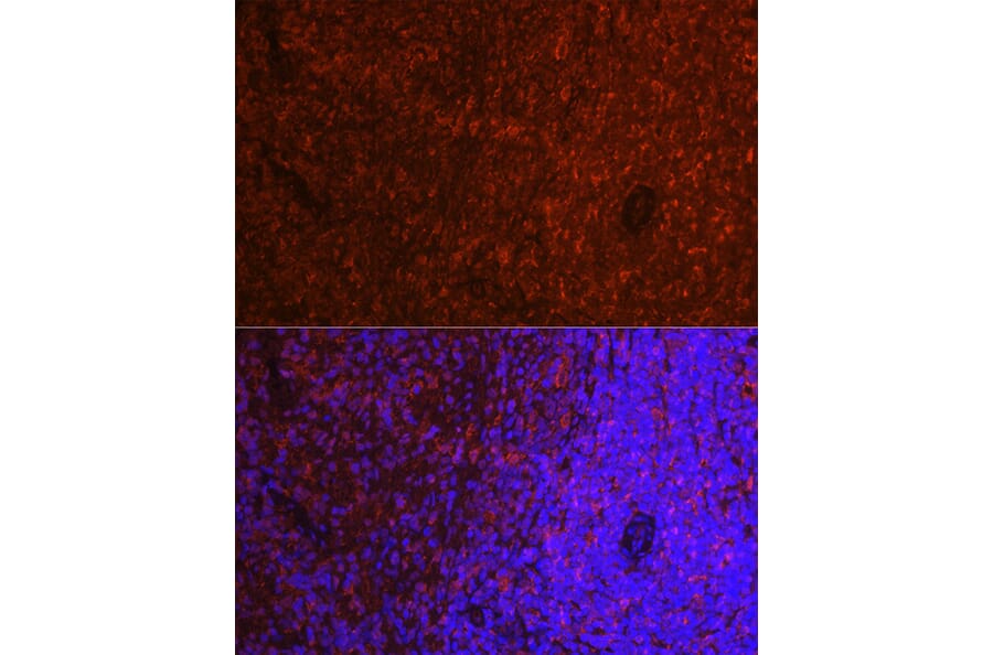 Immunofluorescence - Anti-TMS1/ASC Antibody (A13346) - Antibodies.com