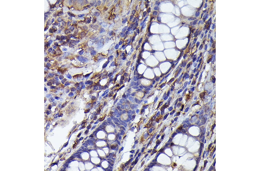 Immunohistochemistry - Anti-Beta Arrestin 2 Antibody (A13347) - Antibodies.com