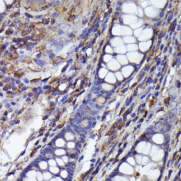 Immunohistochemistry - Anti-Beta Arrestin 2 Antibody (A13347) - Antibodies.com