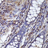 Immunohistochemistry - Anti-Beta Arrestin 2 Antibody (A13347) - Antibodies.com