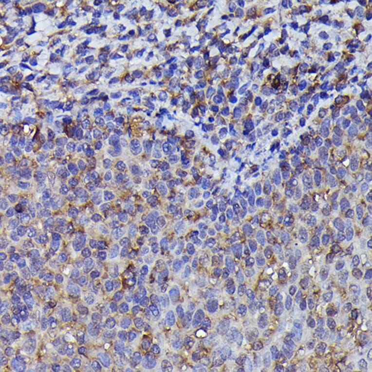 Immunohistochemistry - Anti-Beta Arrestin 2 Antibody (A13347) - Antibodies.com