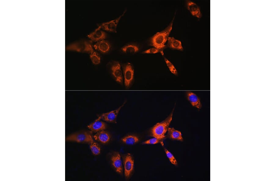 Immunofluorescence - Anti-Beta Arrestin 2 Antibody (A13347) - Antibodies.com