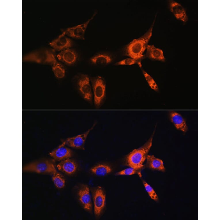 Immunofluorescence - Anti-Beta Arrestin 2 Antibody (A13347) - Antibodies.com