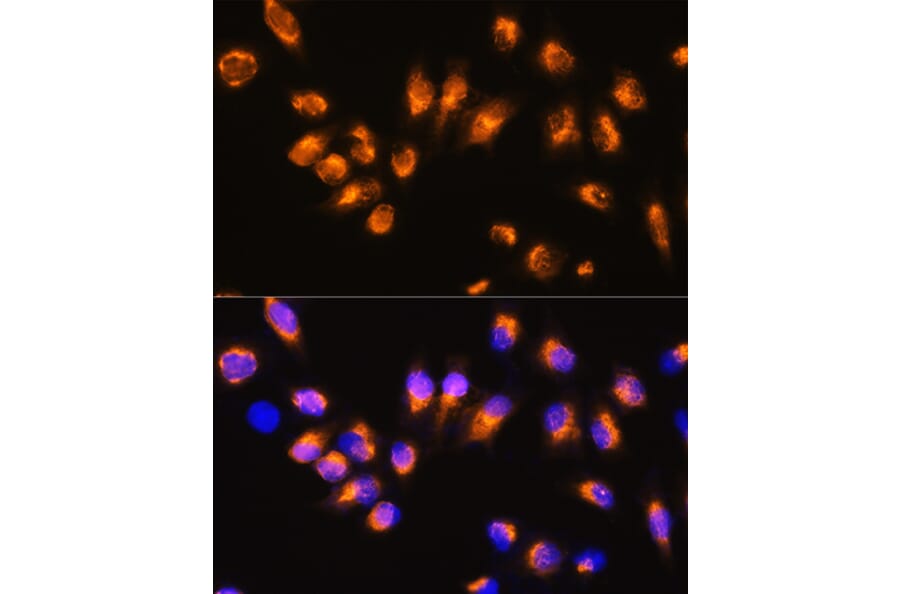 Immunofluorescence - Anti-Beta Arrestin 2 Antibody (A13347) - Antibodies.com