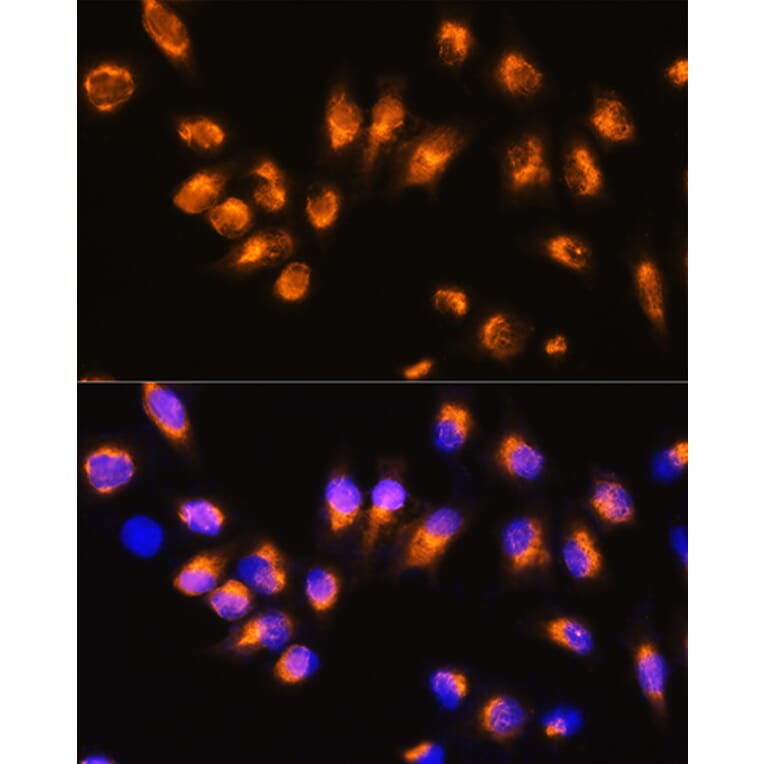 Immunofluorescence - Anti-Beta Arrestin 2 Antibody (A13347) - Antibodies.com