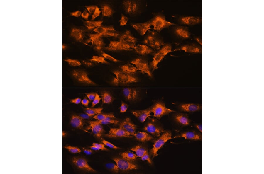 Immunofluorescence - Anti-Beta Arrestin 2 Antibody (A13347) - Antibodies.com