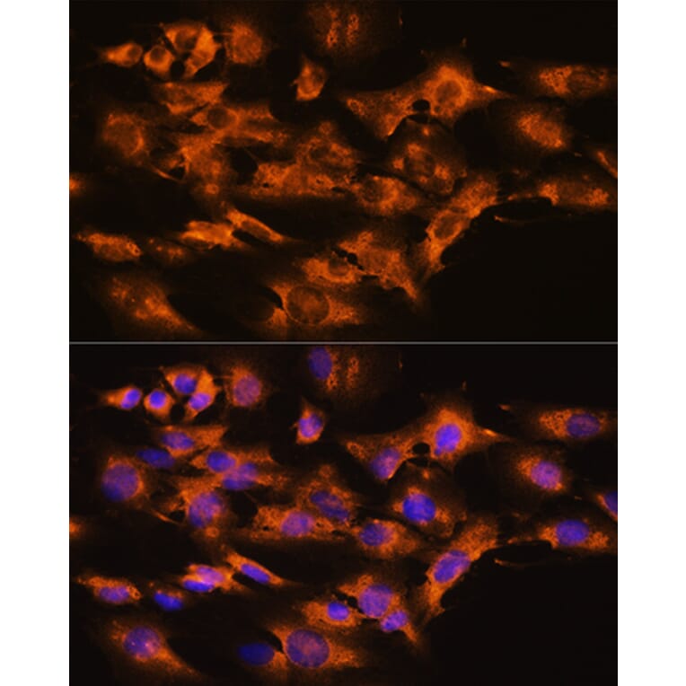 Immunofluorescence - Anti-Beta Arrestin 2 Antibody (A13347) - Antibodies.com