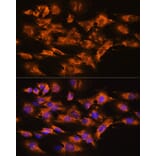 Immunofluorescence - Anti-Beta Arrestin 2 Antibody (A13347) - Antibodies.com