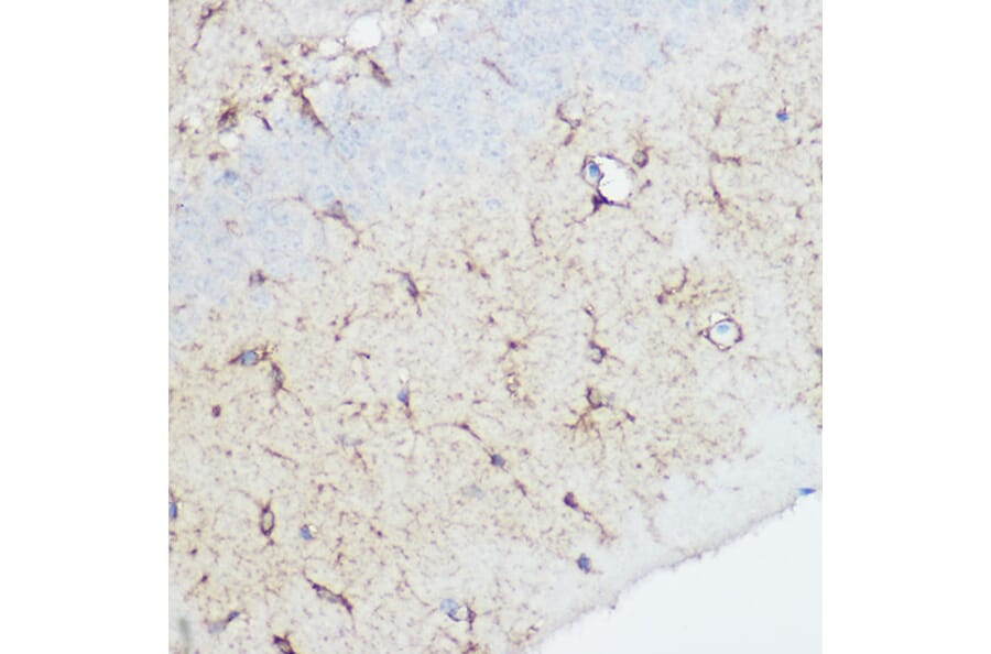 Immunohistochemistry - Anti-Calpain 1 Antibody (A13348) - Antibodies.com