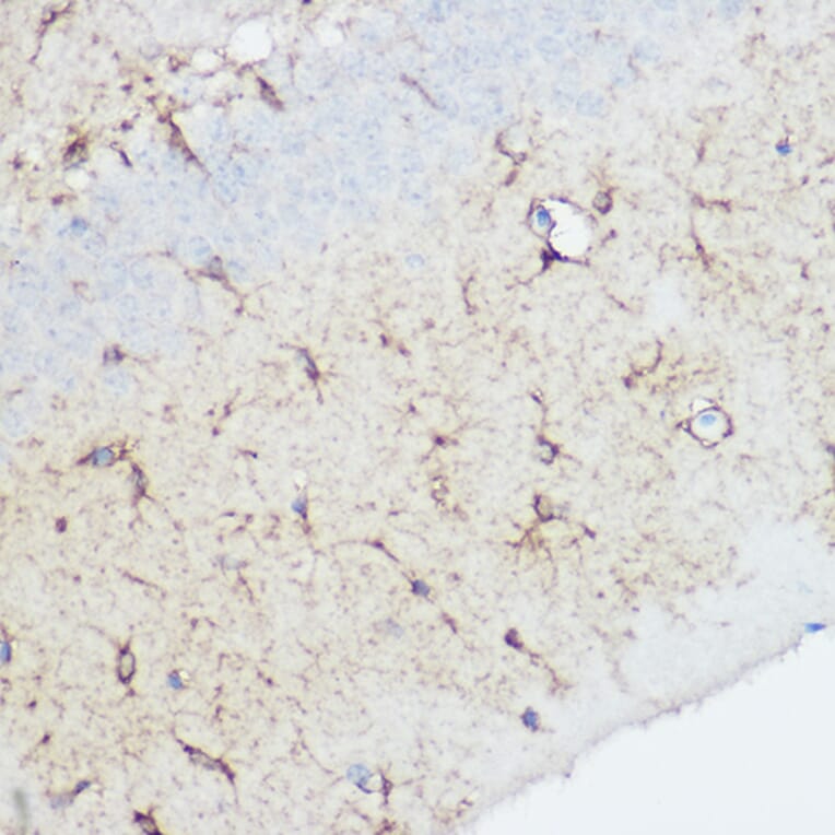 Immunohistochemistry - Anti-Calpain 1 Antibody (A13348) - Antibodies.com