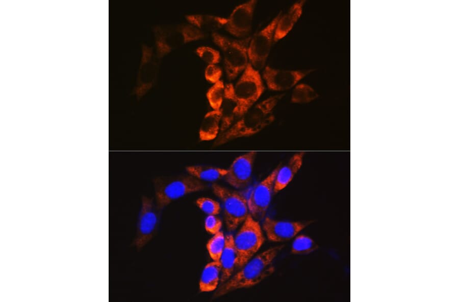 Immunofluorescence - Anti-Calpain 1 Antibody (A13348) - Antibodies.com