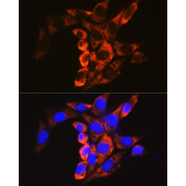 Immunofluorescence - Anti-Calpain 1 Antibody (A13348) - Antibodies.com