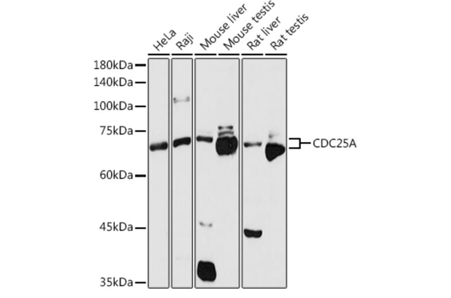 Western Blot - Anti-Cdc25A Antibody (A13349) - Antibodies.com