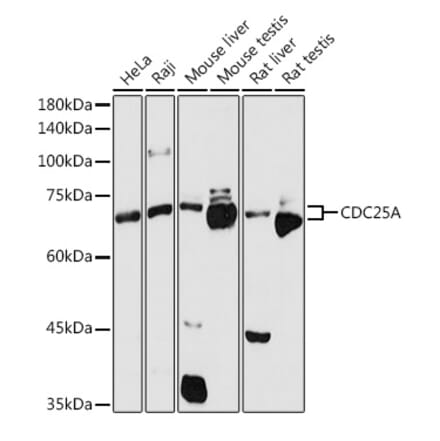 Western Blot - Anti-Cdc25A Antibody (A13349) - Antibodies.com
