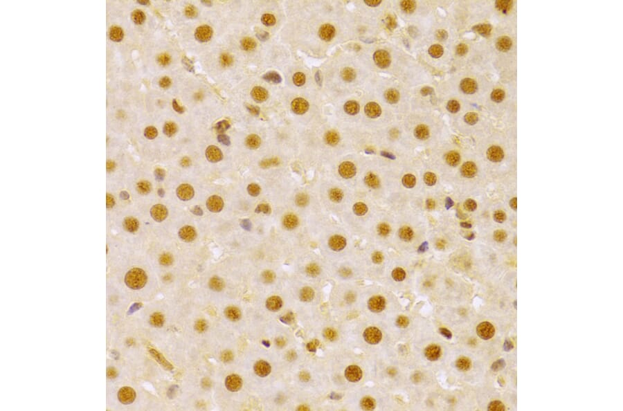 Immunohistochemistry - Anti-Cdc25A Antibody (A13349) - Antibodies.com