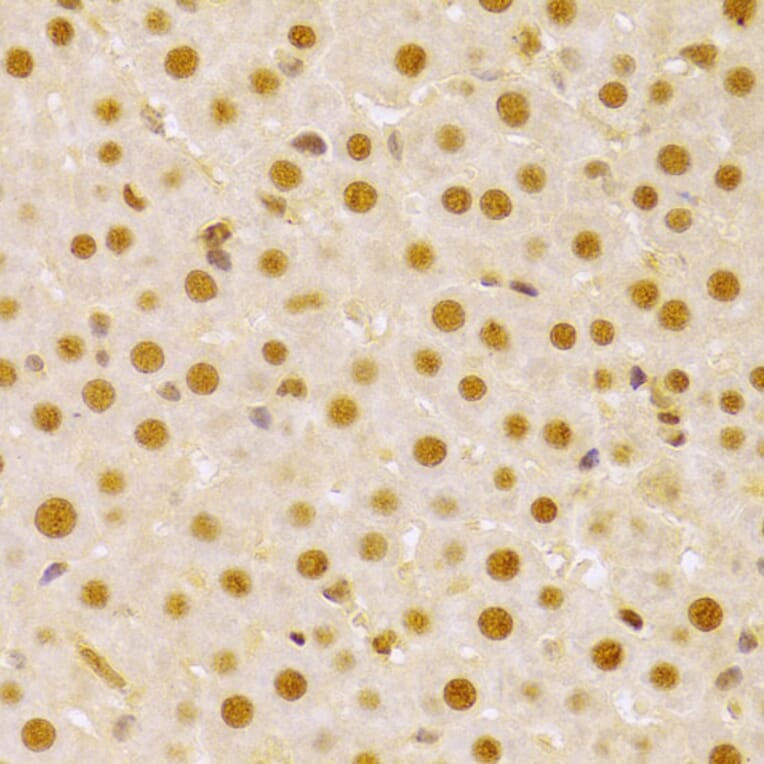 Immunohistochemistry - Anti-Cdc25A Antibody (A13349) - Antibodies.com