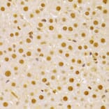 Immunohistochemistry - Anti-Cdc25A Antibody (A13349) - Antibodies.com
