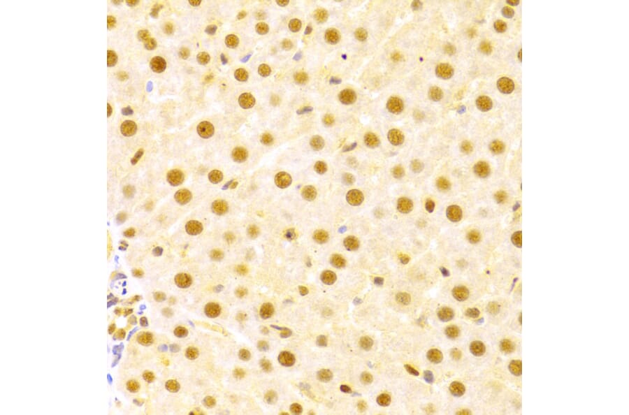 Immunohistochemistry - Anti-Cdc25A Antibody (A13349) - Antibodies.com