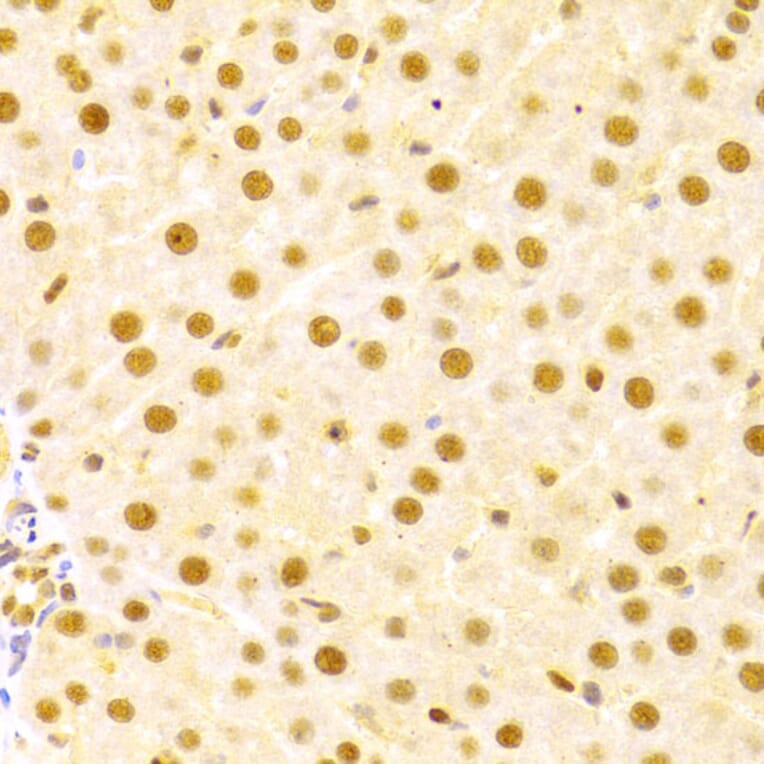Immunohistochemistry - Anti-Cdc25A Antibody (A13349) - Antibodies.com
