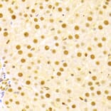 Immunohistochemistry - Anti-Cdc25A Antibody (A13349) - Antibodies.com