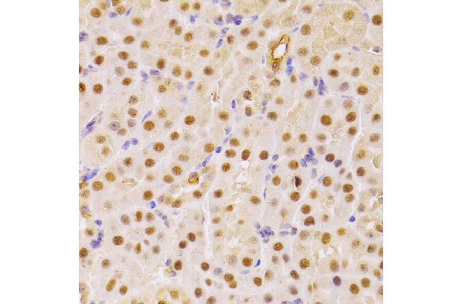 Immunohistochemistry - Anti-Cdc25A Antibody (A13349) - Antibodies.com