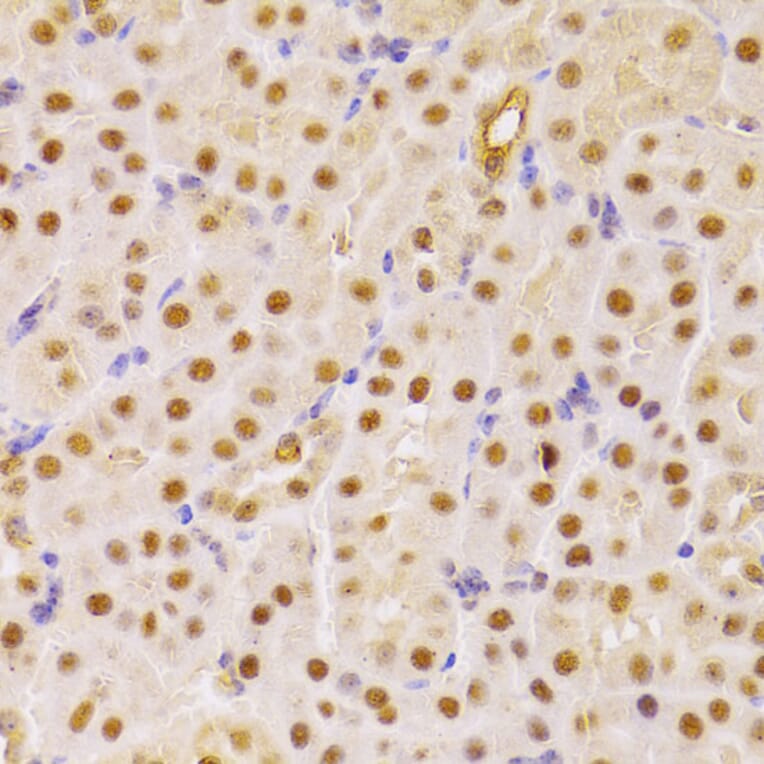 Immunohistochemistry - Anti-Cdc25A Antibody (A13349) - Antibodies.com