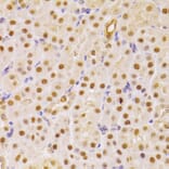 Immunohistochemistry - Anti-Cdc25A Antibody (A13349) - Antibodies.com