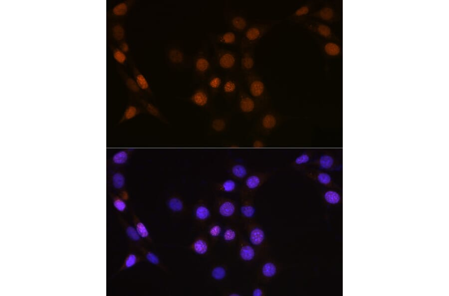 Immunofluorescence - Anti-Cdc25A Antibody (A13349) - Antibodies.com