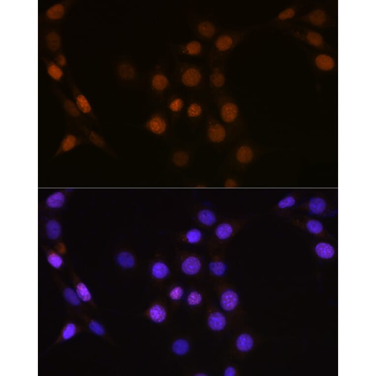 Immunofluorescence - Anti-Cdc25A Antibody (A13349) - Antibodies.com