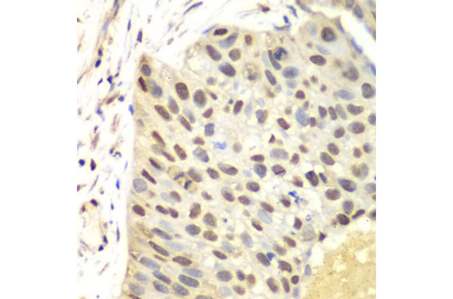 Immunohistochemistry - Anti-FEN1 Antibody (A13351) - Antibodies.com