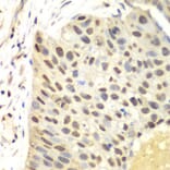 Immunohistochemistry - Anti-FEN1 Antibody (A13351) - Antibodies.com