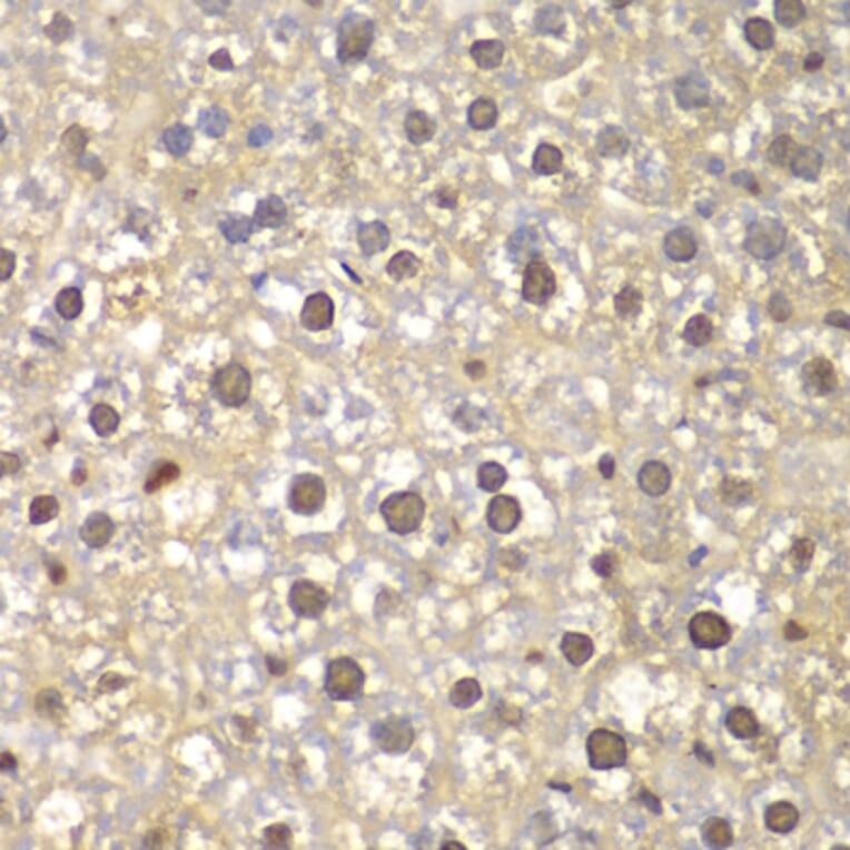 Immunohistochemistry - Anti-FEN1 Antibody (A13351) - Antibodies.com