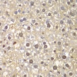 Immunohistochemistry - Anti-FEN1 Antibody (A13351) - Antibodies.com