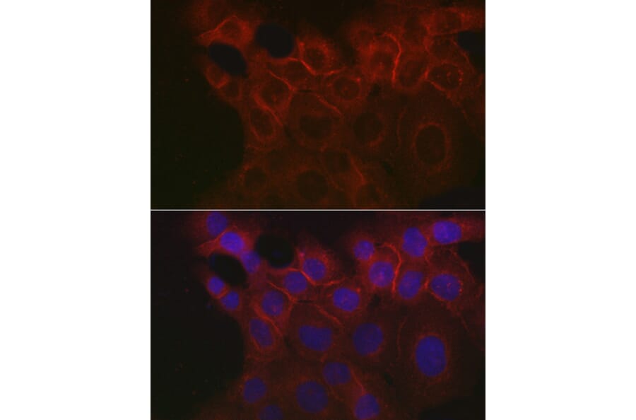 Immunofluorescence - Anti-EpCAM Antibody (A13353) - Antibodies.com