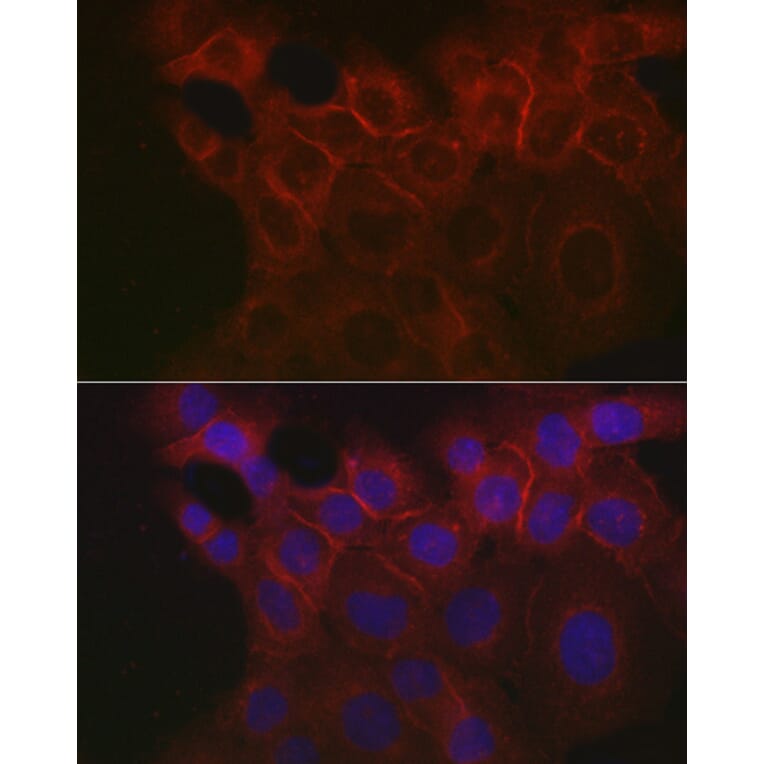 Immunofluorescence - Anti-EpCAM Antibody (A13353) - Antibodies.com