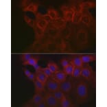 Immunofluorescence - Anti-EpCAM Antibody (A13353) - Antibodies.com