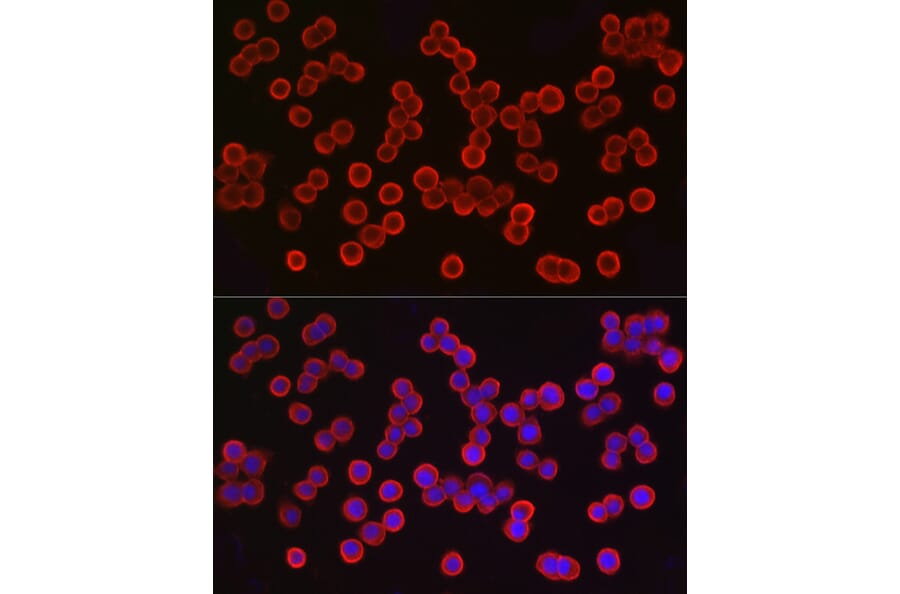 Immunofluorescence - Anti-EpCAM Antibody (A13353) - Antibodies.com