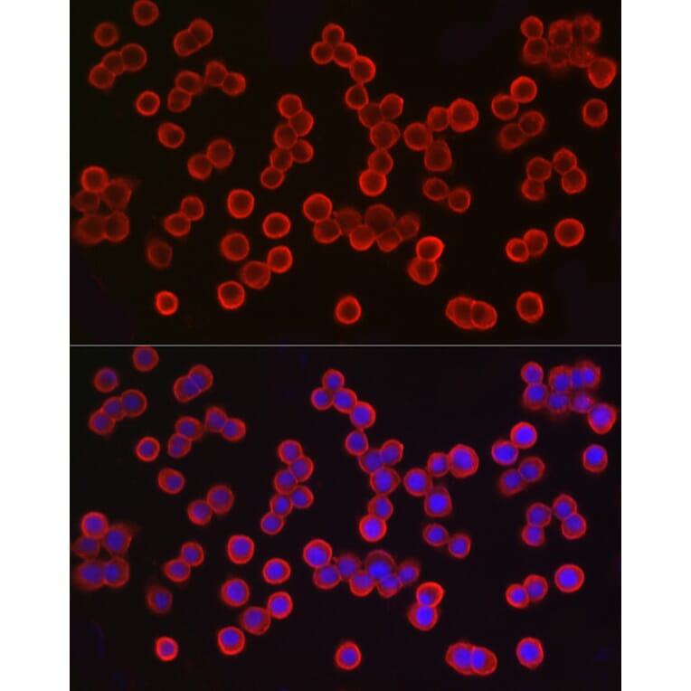 Immunofluorescence - Anti-EpCAM Antibody (A13353) - Antibodies.com
