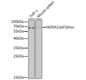 Western Blot - Anti-NOXA2/p67phox Antibody (A13354) - Antibodies.com