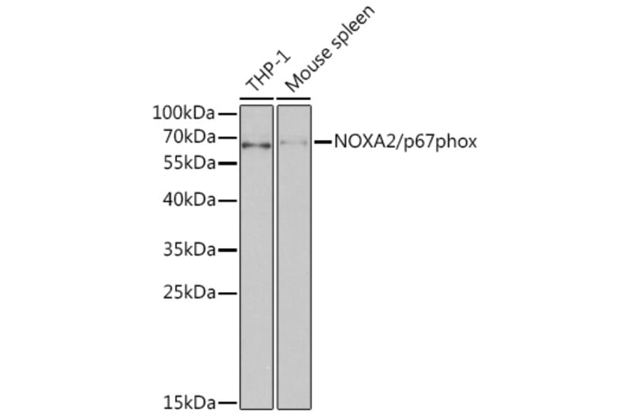 Western Blot - Anti-NOXA2/p67phox Antibody (A13354) - Antibodies.com