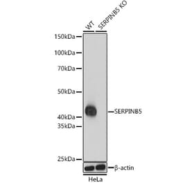 Western Blot - Anti-MASPIN Antibody (A13355) - Antibodies.com