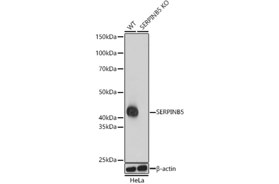 Western Blot - Anti-MASPIN Antibody (A13355) - Antibodies.com